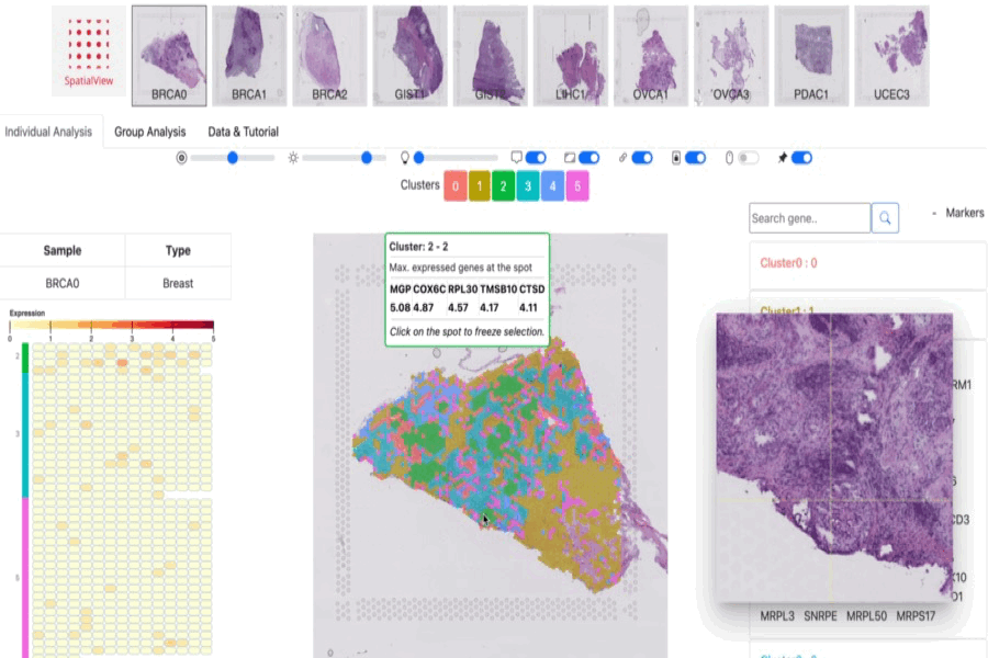 SpatialView